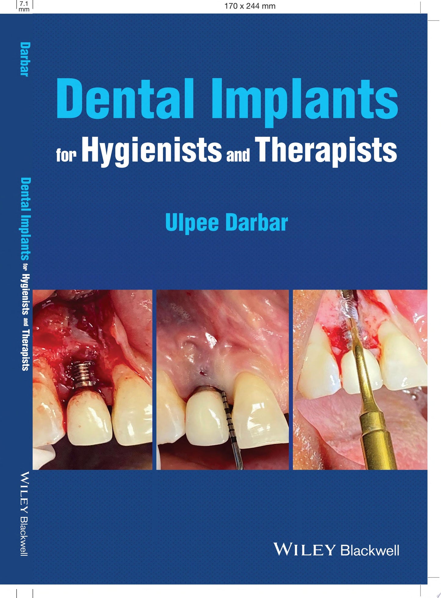 Dental Implants for Hygienists and Therapists