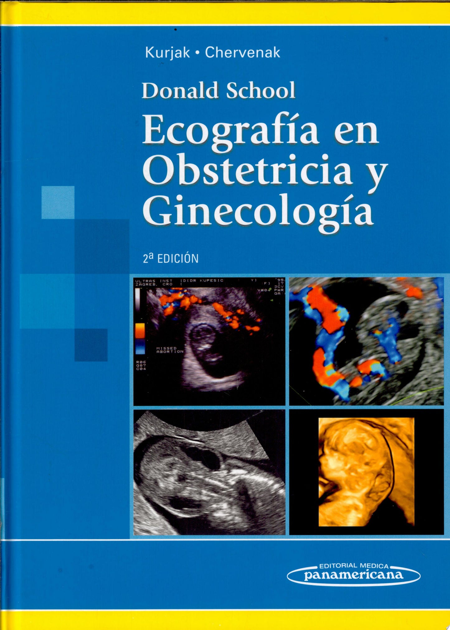 Ecocardiografía fetal