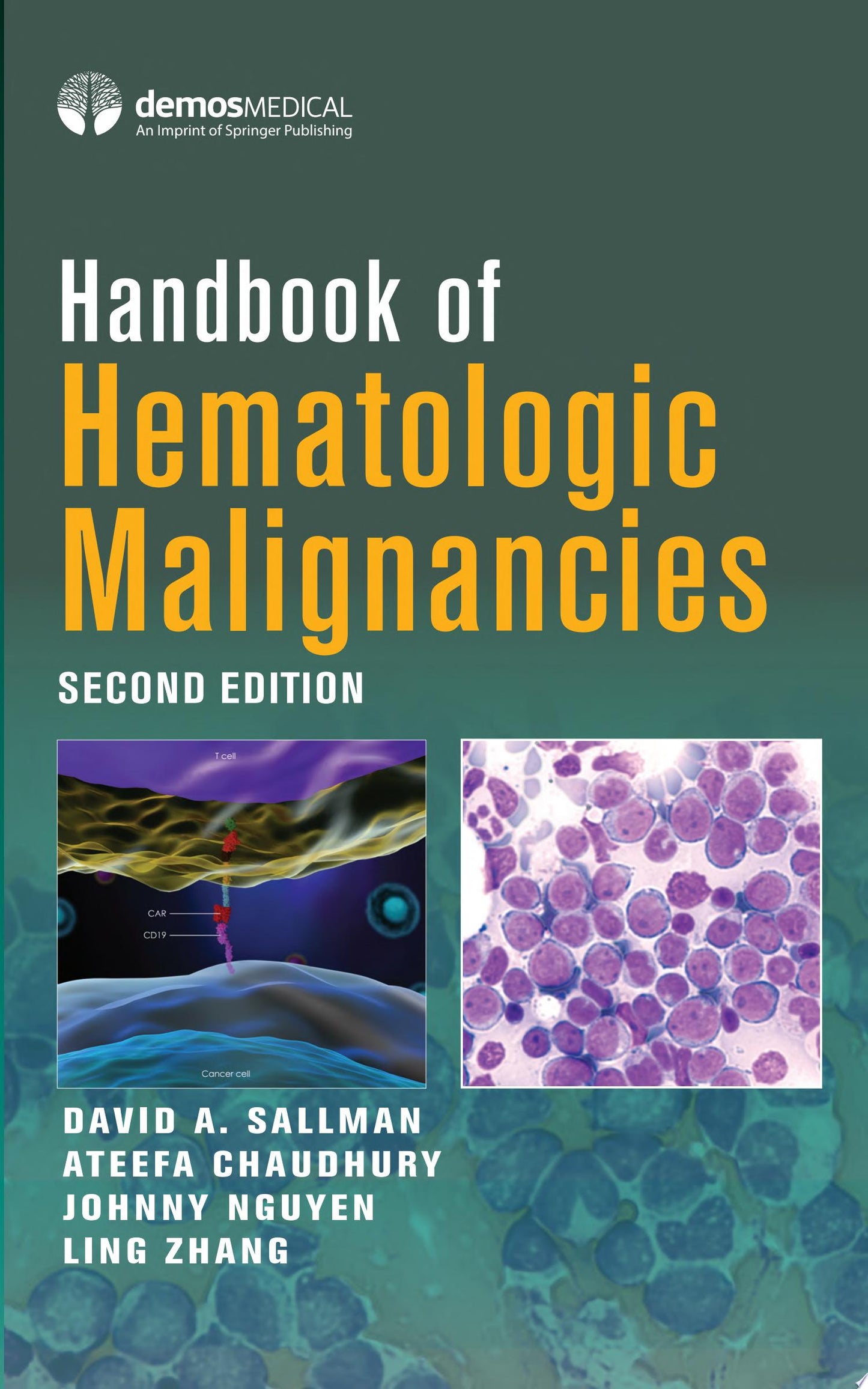 Lymphoid Malignancies, 2nd Edition