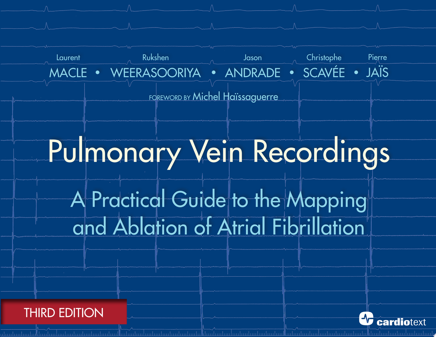 Pulmonary Vein Recordings: A Practical Guide to the Mapping and Ablation of Atrial Fibrillation