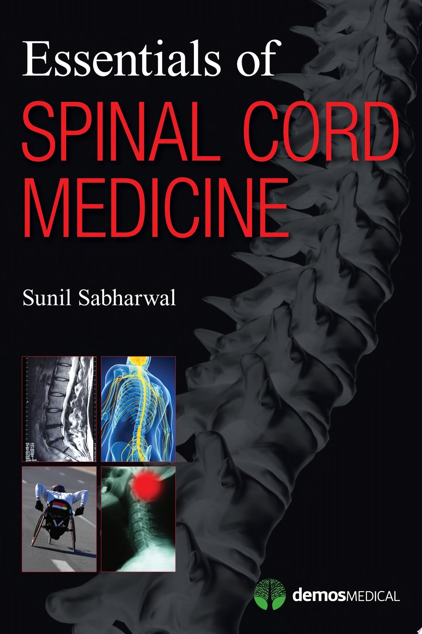 Essentials of Spinal Cord Medicine