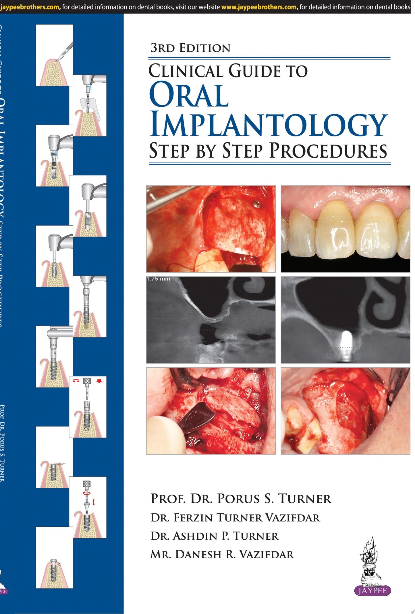 Clinical Guide to Oral Implantology