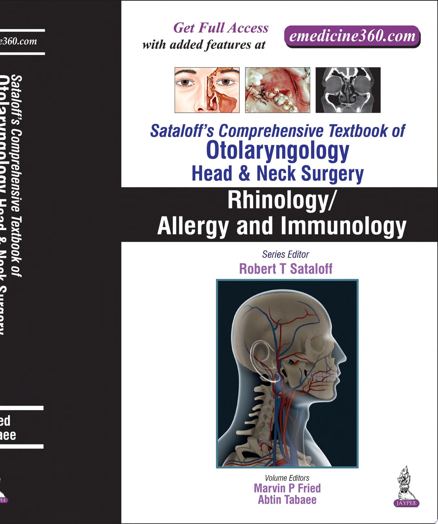 Osteonecrosis, 2nd Edition