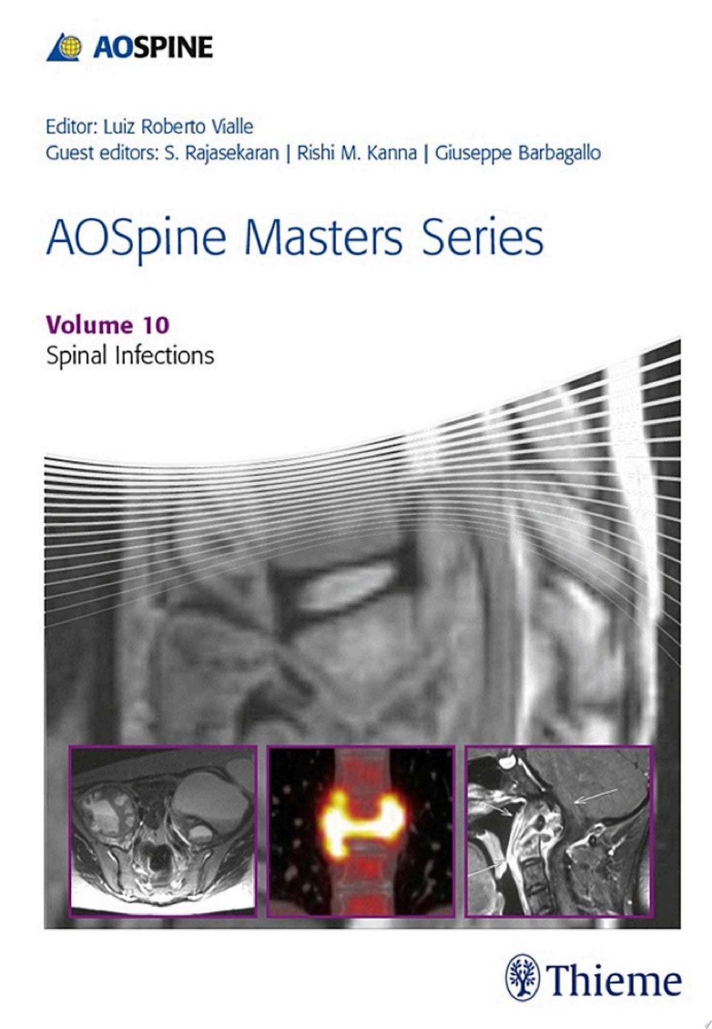AOSpine Masters Series, Volume 10: Spinal Infections (PDF)