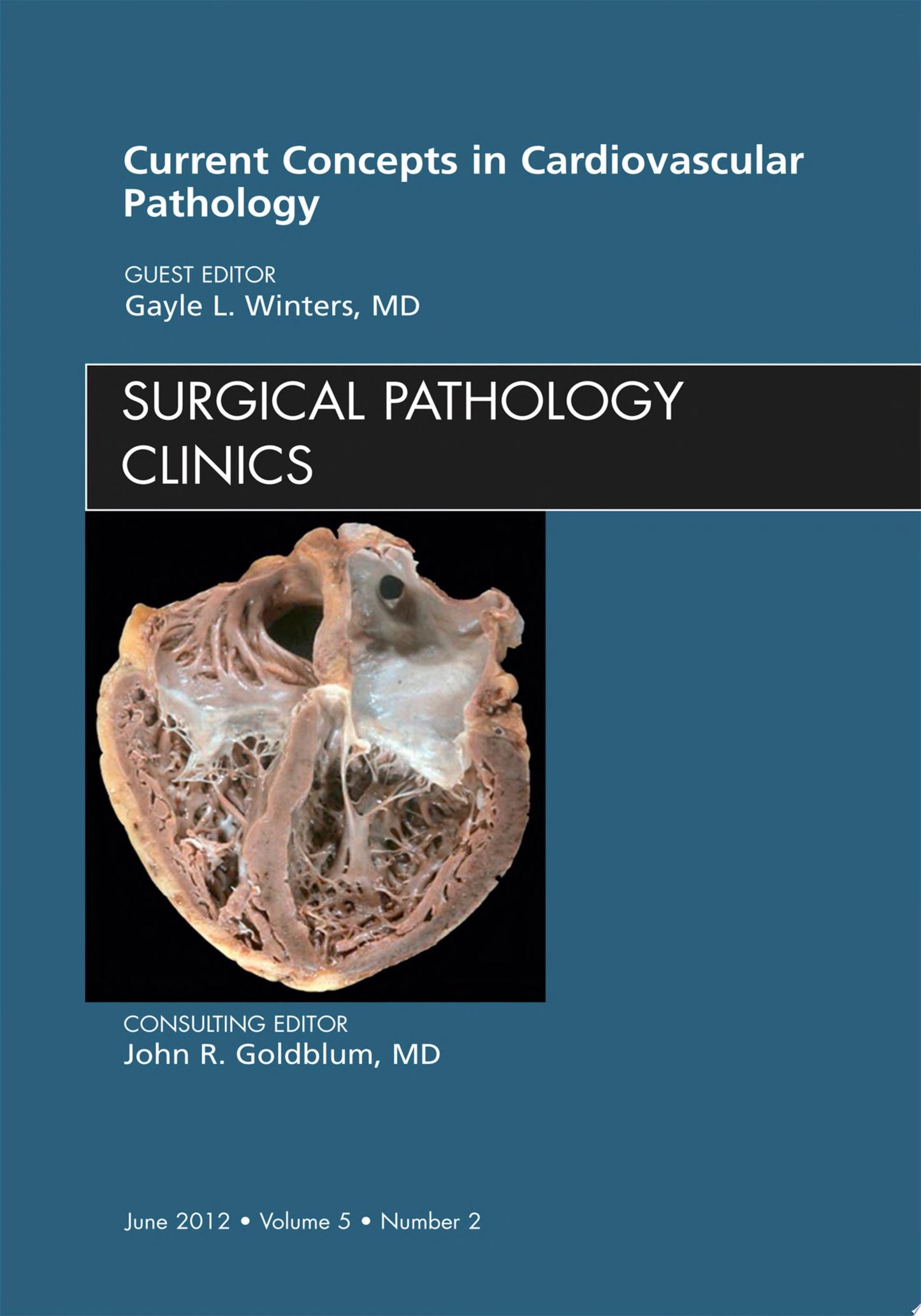 Current Concepts in Cardiovascular Pathology, An Issue of Surgical Pathology Clinics