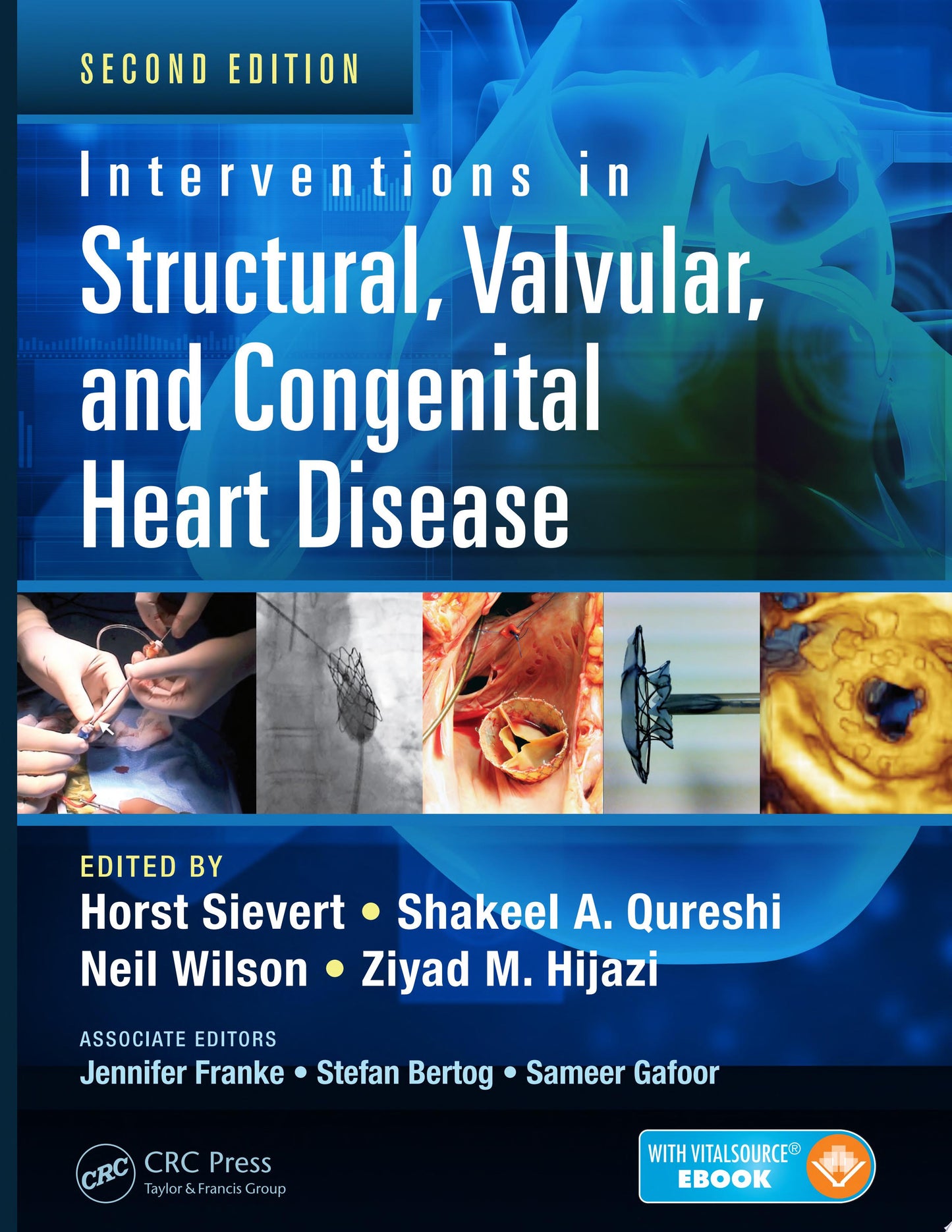 Interventions in Structural, Valvular and Congenital Heart Disease, 2nd Edition