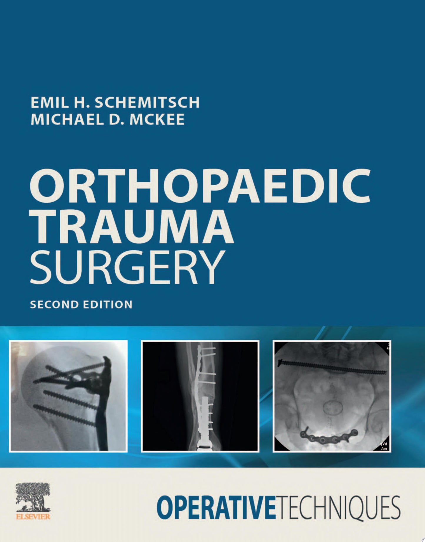 Operative Techniques: Orthopaedic Trauma Surgery, 2nd Edition (ORIGINAL PDF from Publisher)