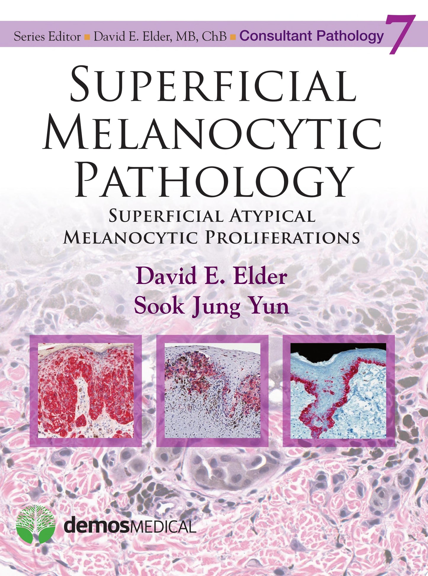 Superficial Melanocytic Pathology