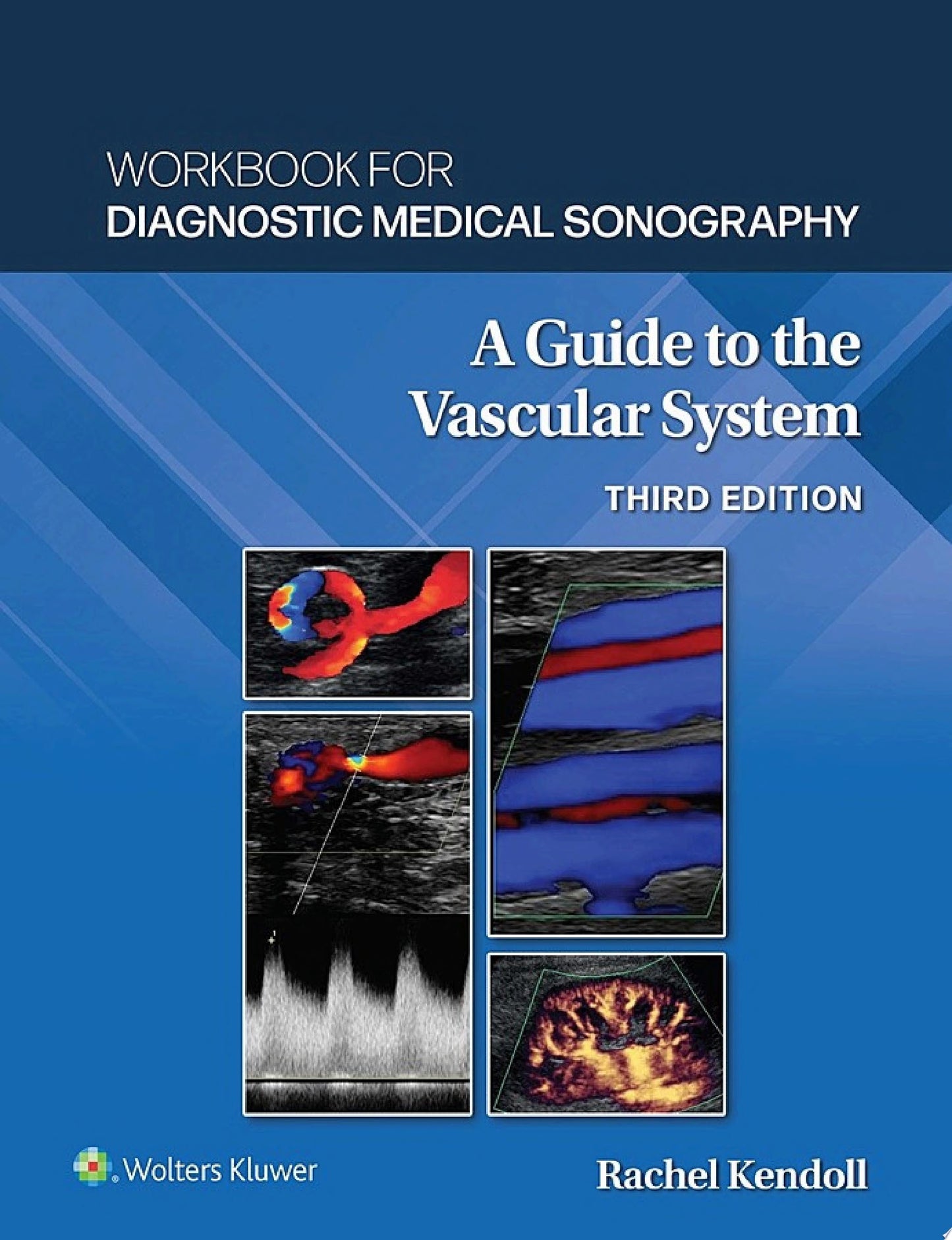 Workbook for Diagnostic Medical Sonography: The Vascular System