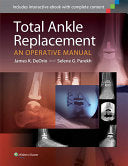 Total Ankle Replacement: An Operative Manual (ORIGINAL PDF from Publisher)