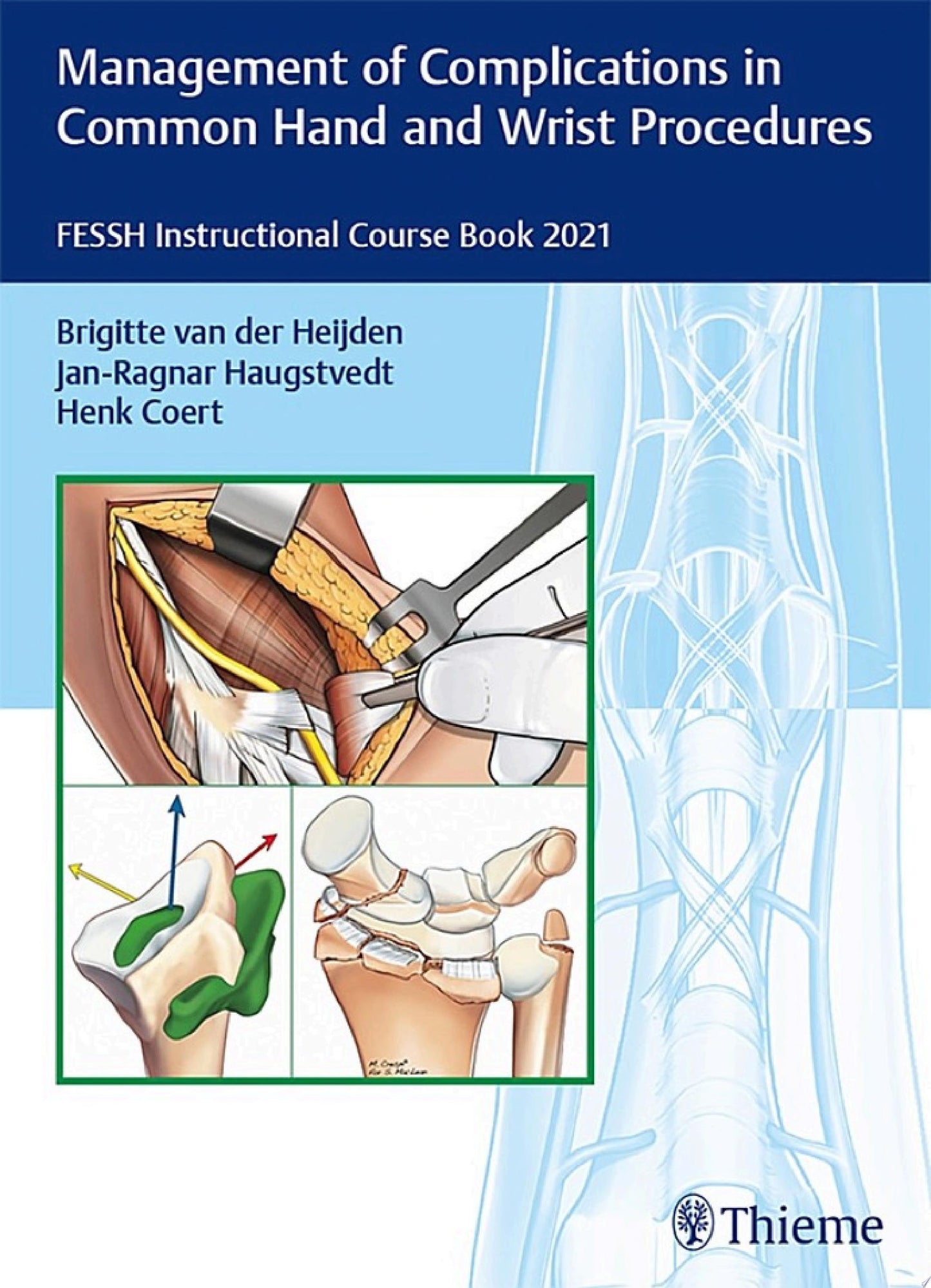 Management of Complications in Common Hand and Wrist Procedures: FESSH Instructional Course Book 2021 (Original PDF From Publisher)