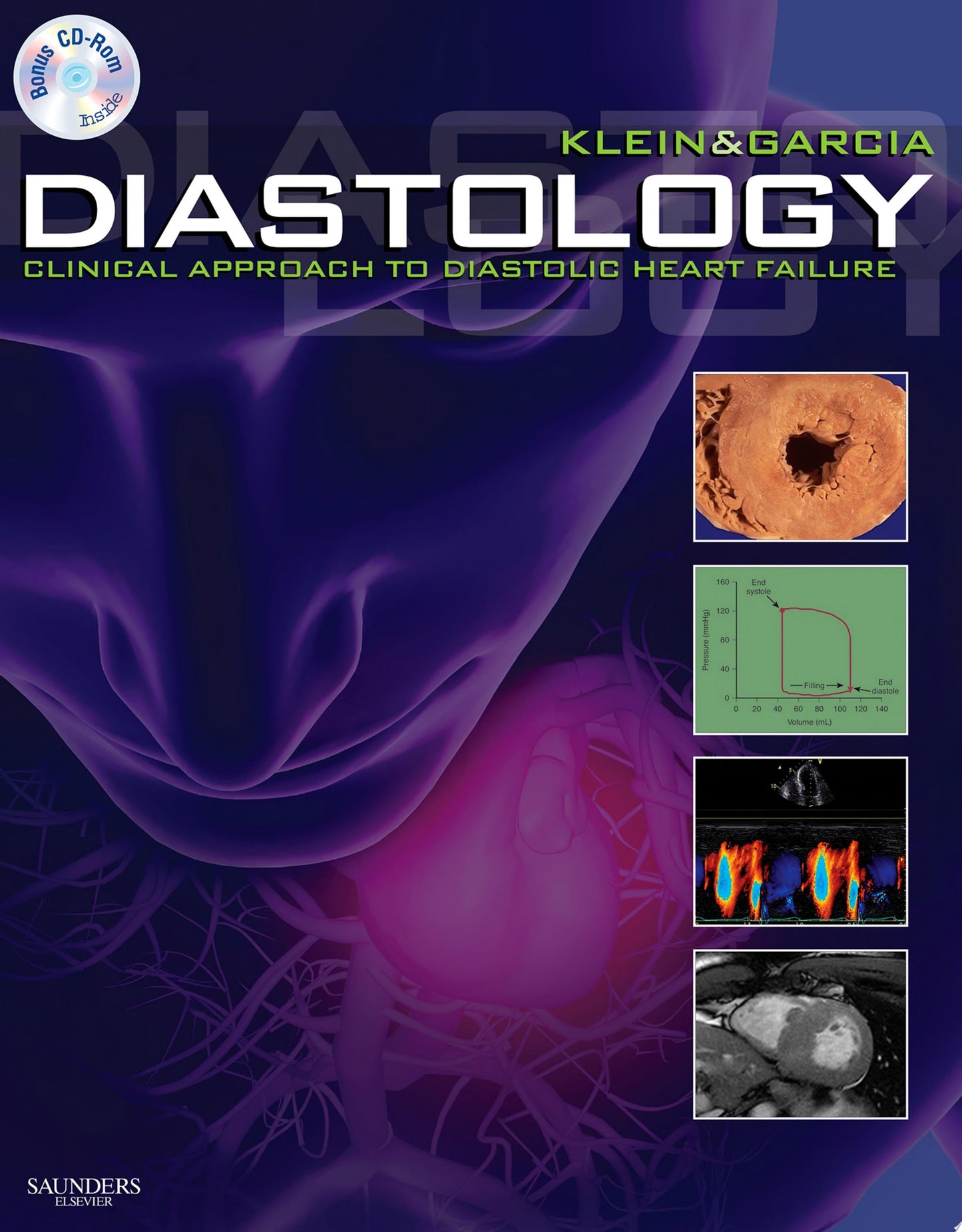 Ventricular Diastolic Function, 2nd edition