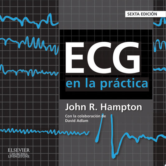 ECG en la práctica