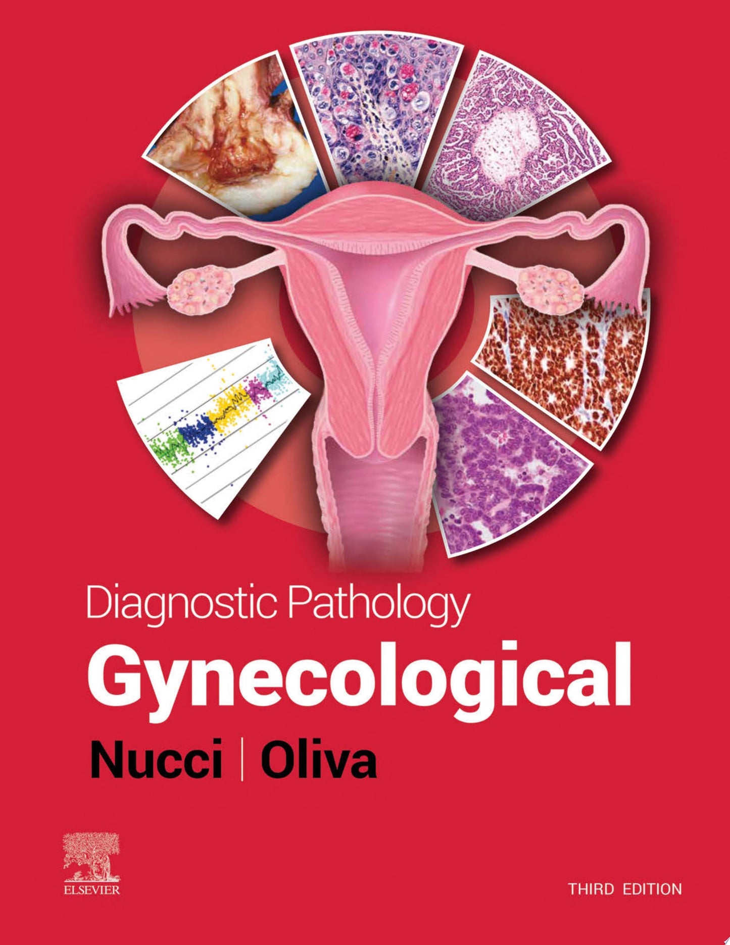 Diagnostic Pathology: Gynecological, 2nd Edition