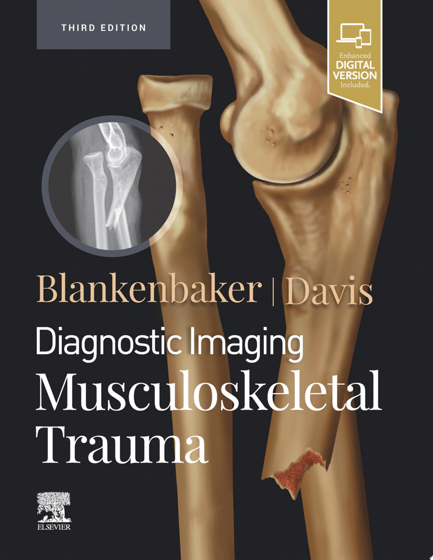 Diagnostic Imaging: Musculoskeletal Trauma, 3rd edition