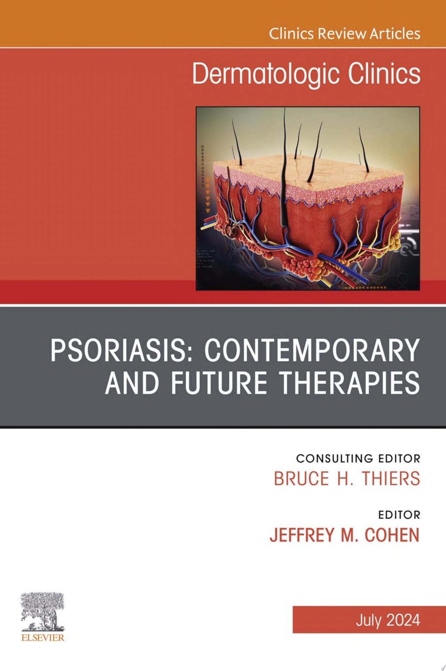 Psoriasis: Contemporary and Future Therapies, An Issue of Dermatologic Clinics