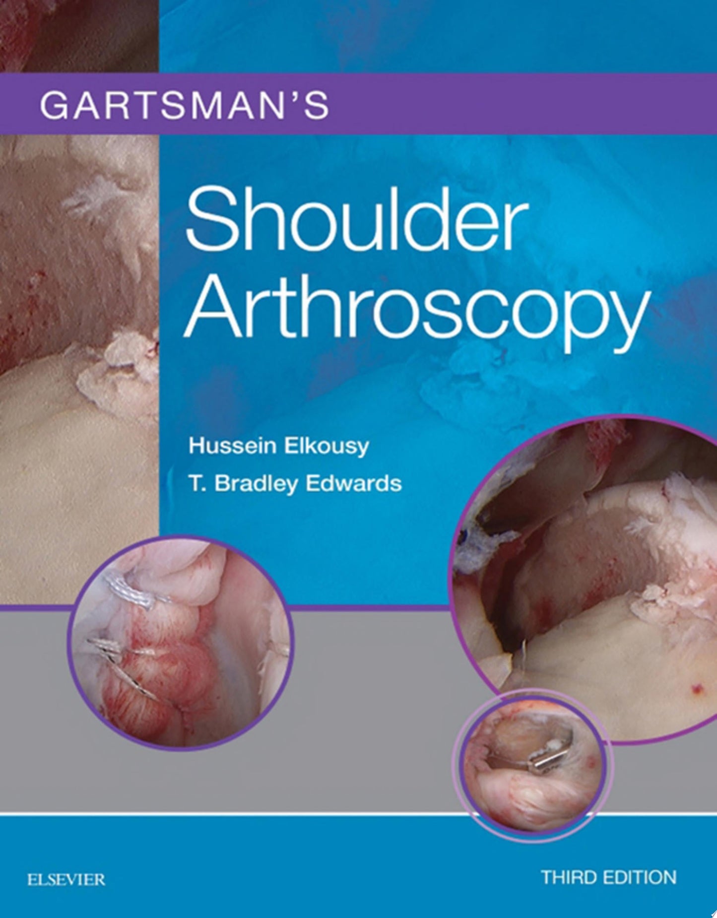Gartsman’s Shoulder Arthroscopy, 3e