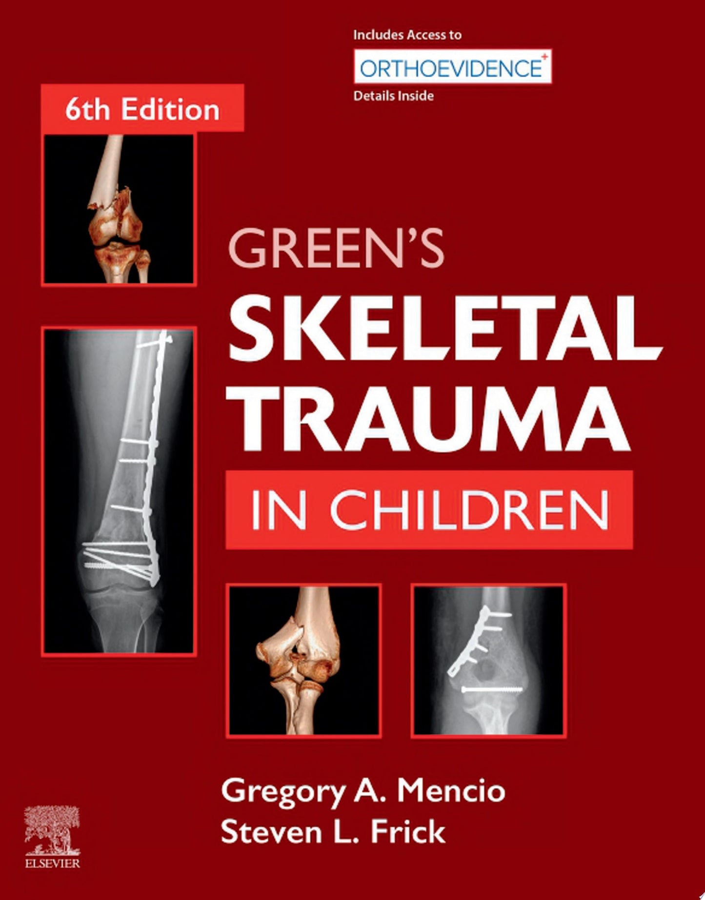 Green’s Skeletal Trauma in Children, 6th Edition