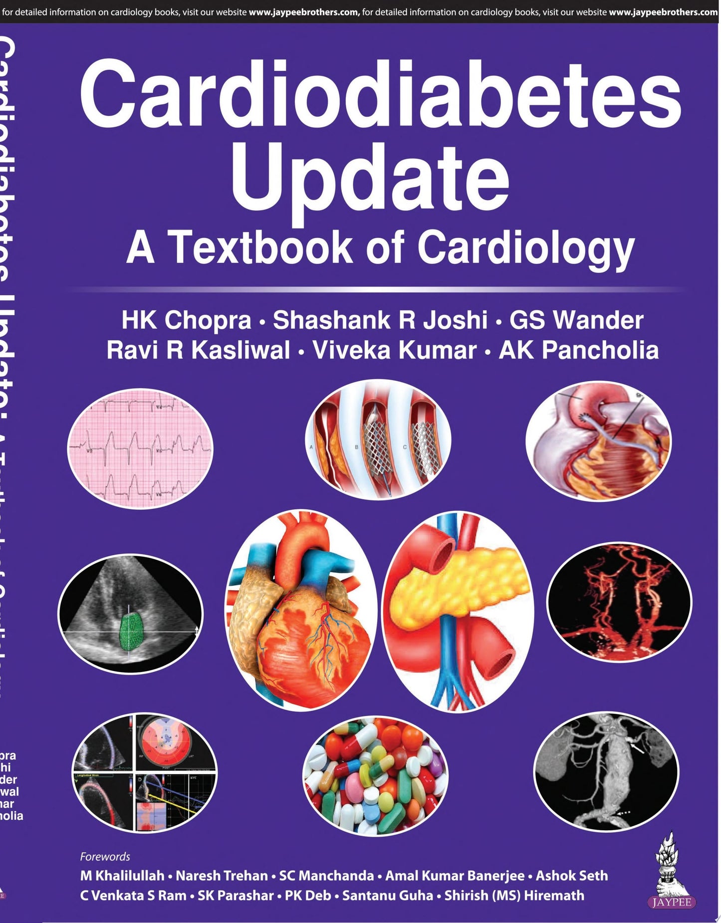 Cardiodiabetes Update a Textbook of Cardiology