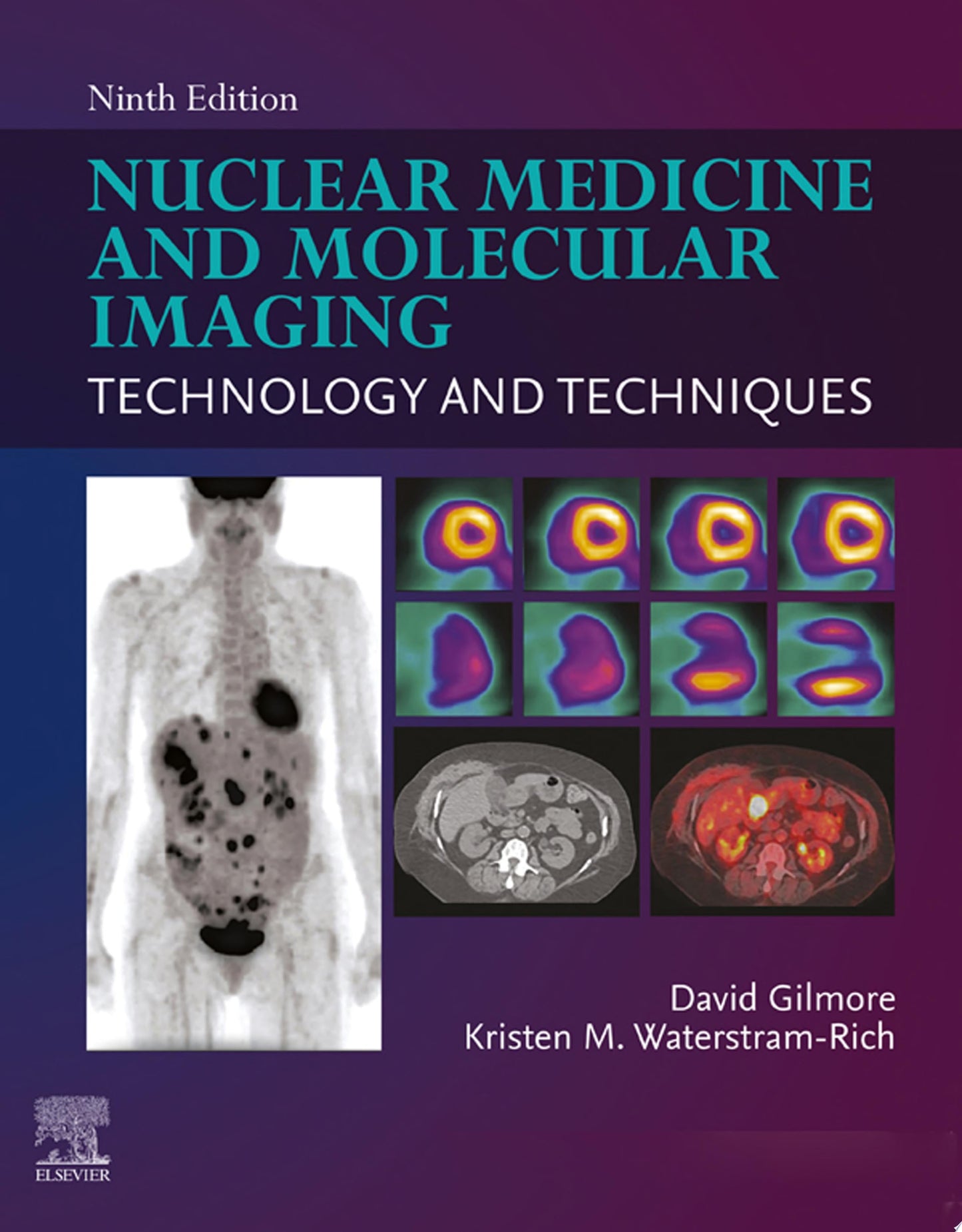 Nuclear Medicine and Molecular Imaging