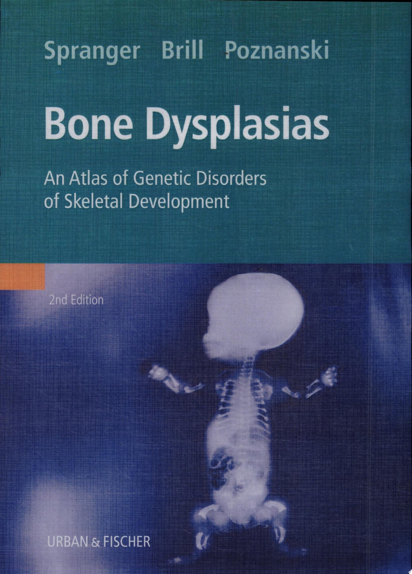 Bone Dysplasias: An Atlas of Genetic Disorders of Skeletal Development (PDF)