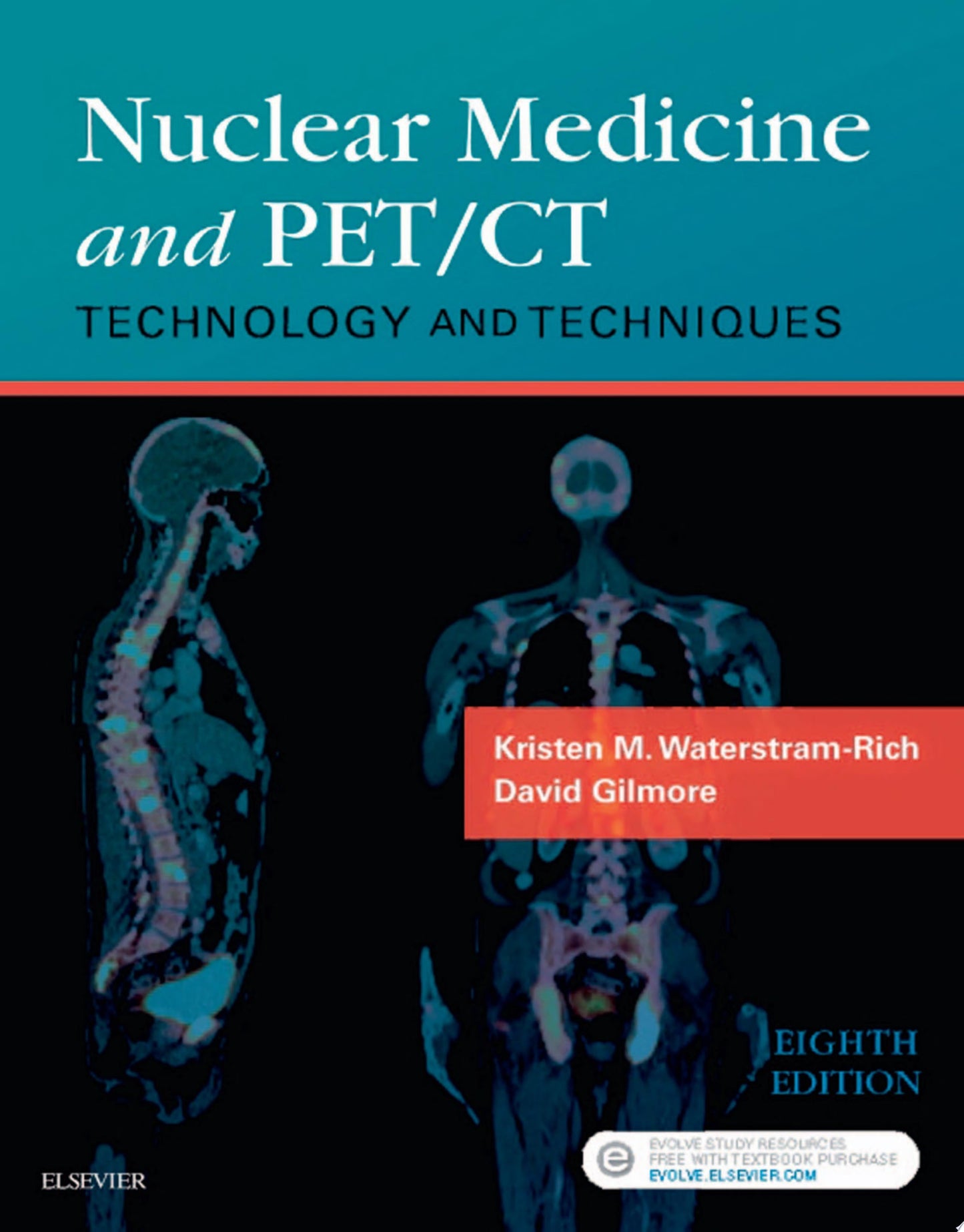 Nuclear Medicine and PET/CT: Technology and Techniques, 8th Edition