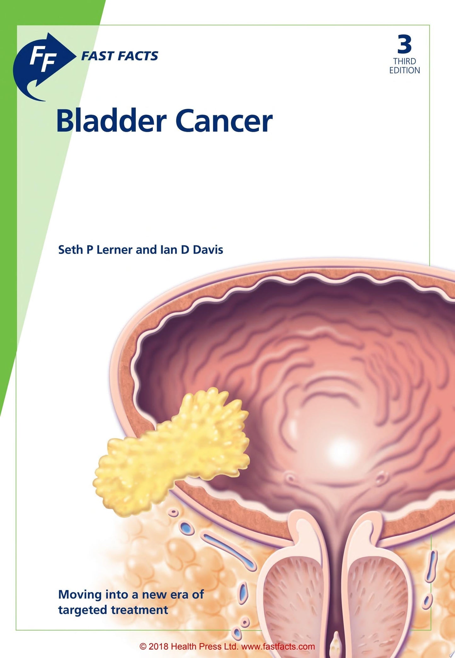 Fast Facts: Bladder Cancer, 3rd edition