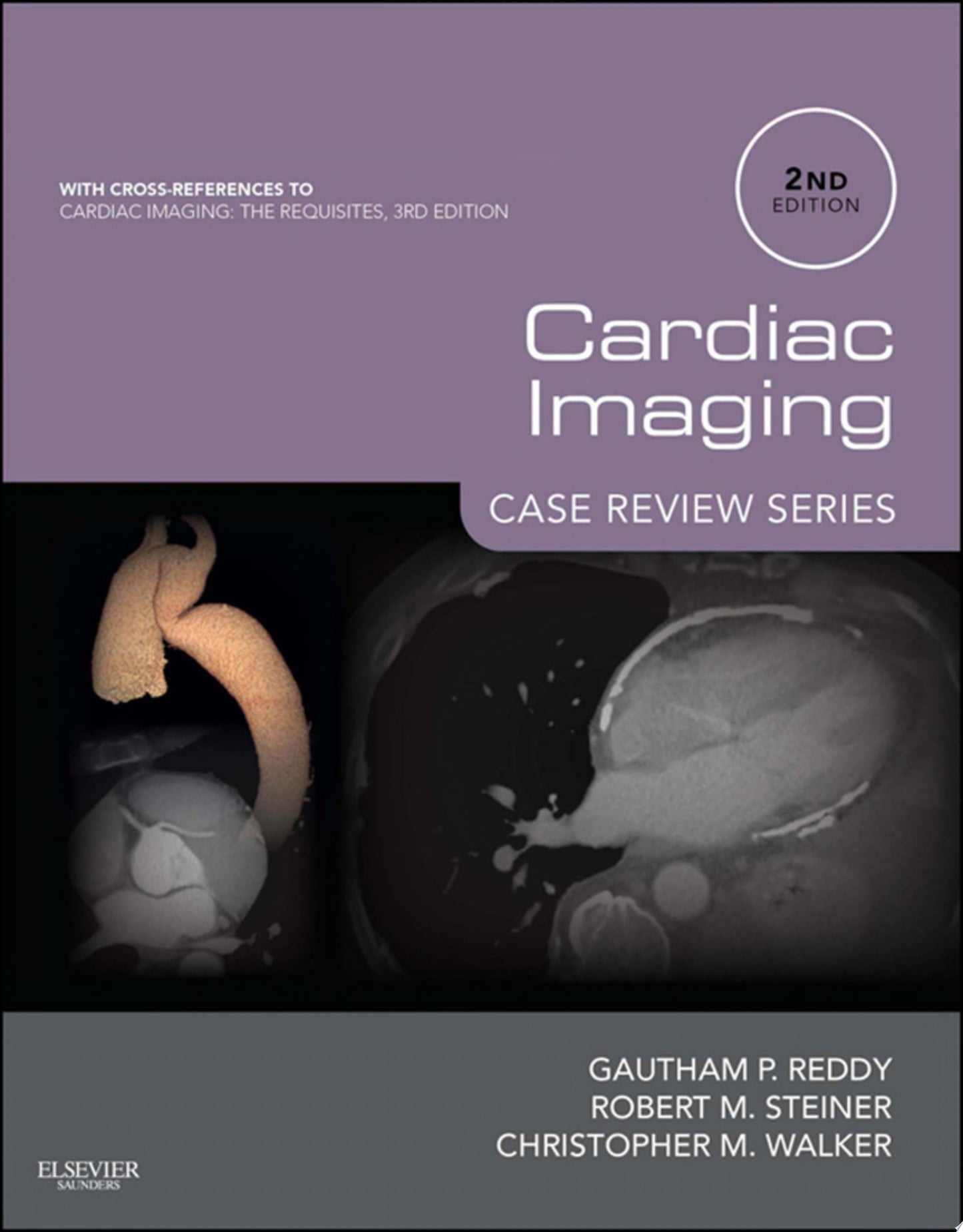 Cardiac Imaging: Case Review Series, 2nd Edition
