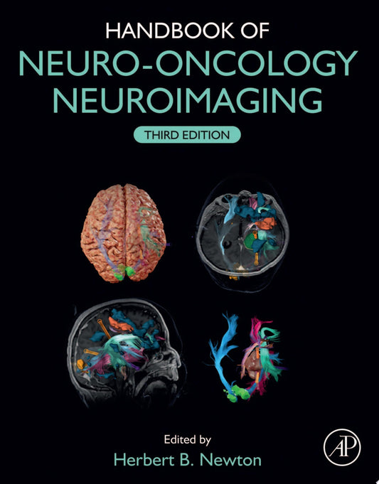 Handbook of Neuro-Oncology Neuroimaging, 3rd Edition