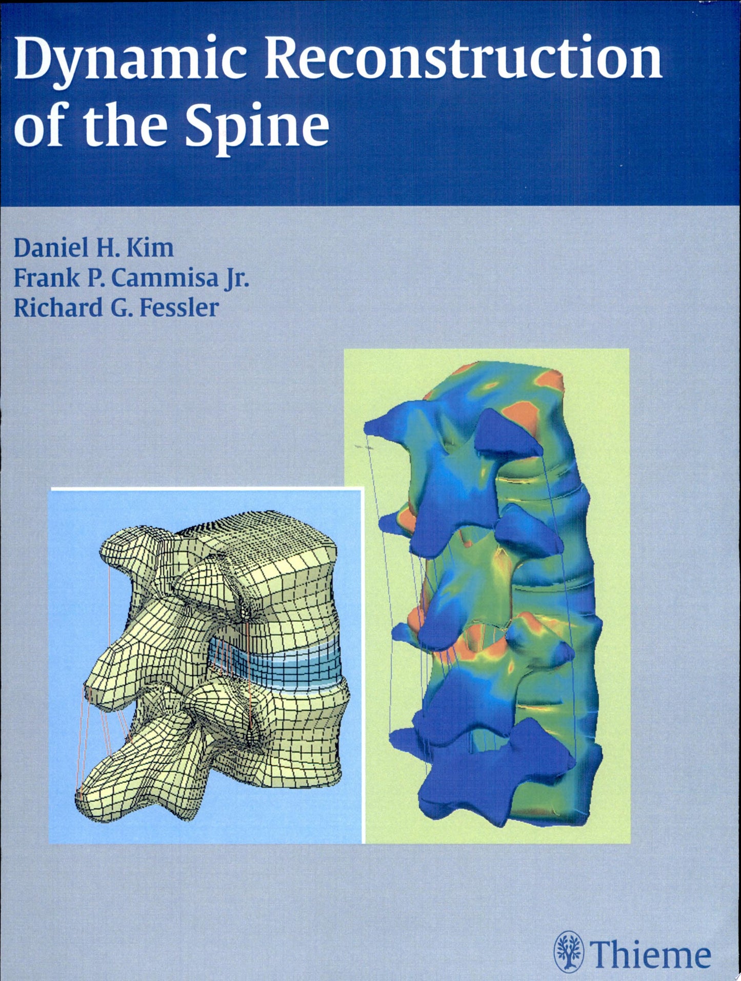 Dynamic Reconstruction of the Spine, 2nd Edition