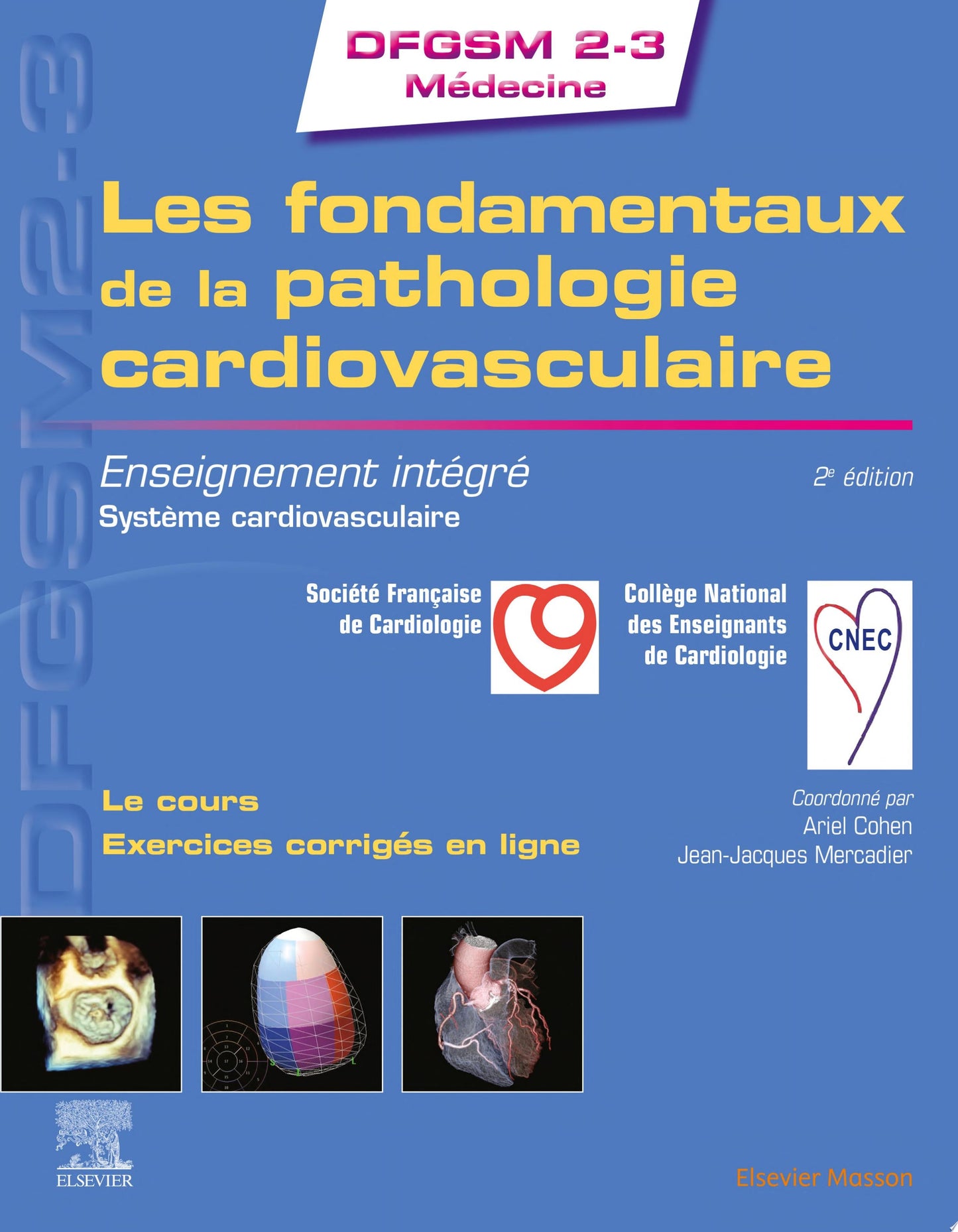 Imagerie cardiaque: scanner et IRM, 2e