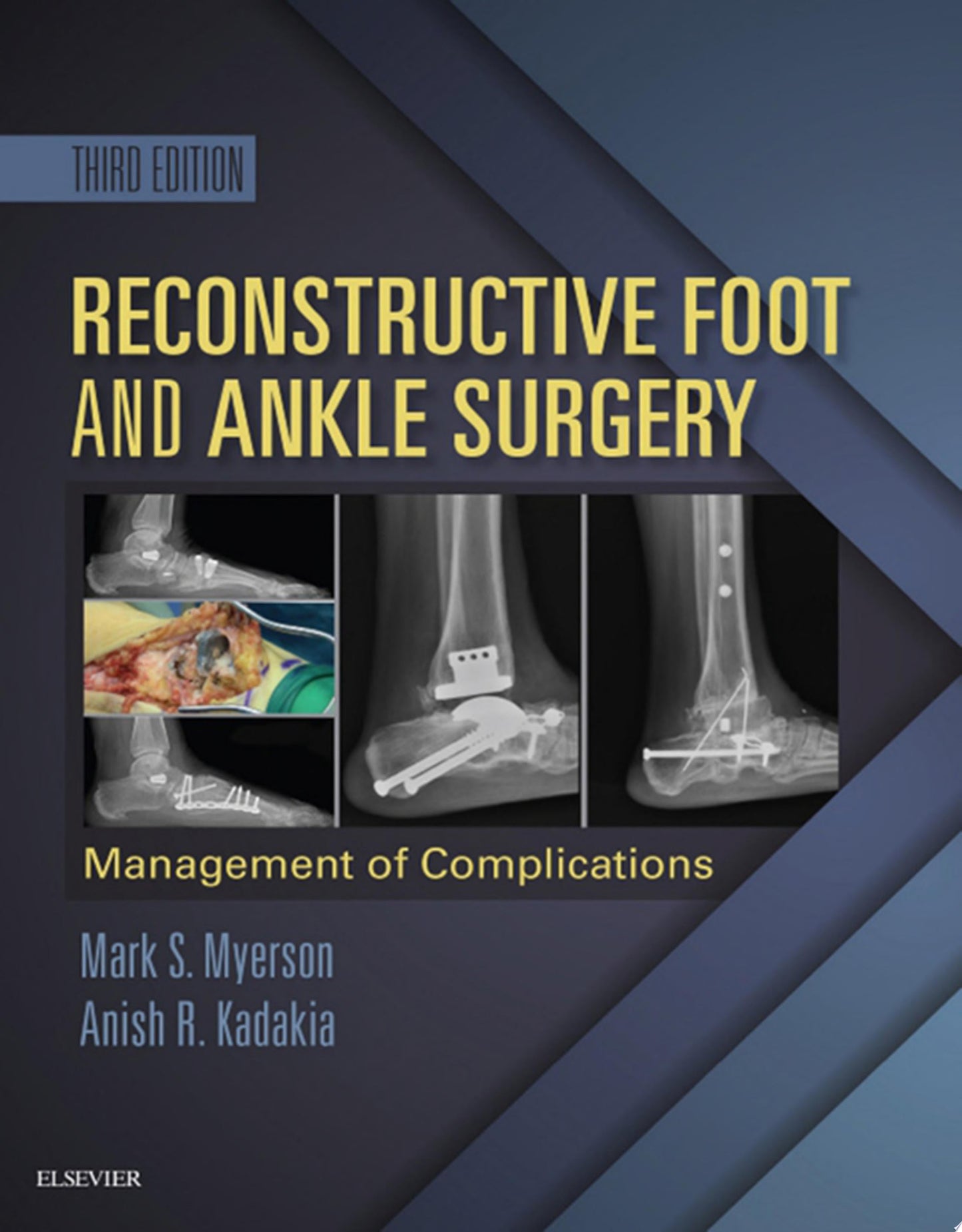 Reconstructive Foot and Ankle Surgery: Management of Complications, 3e (PDF)
