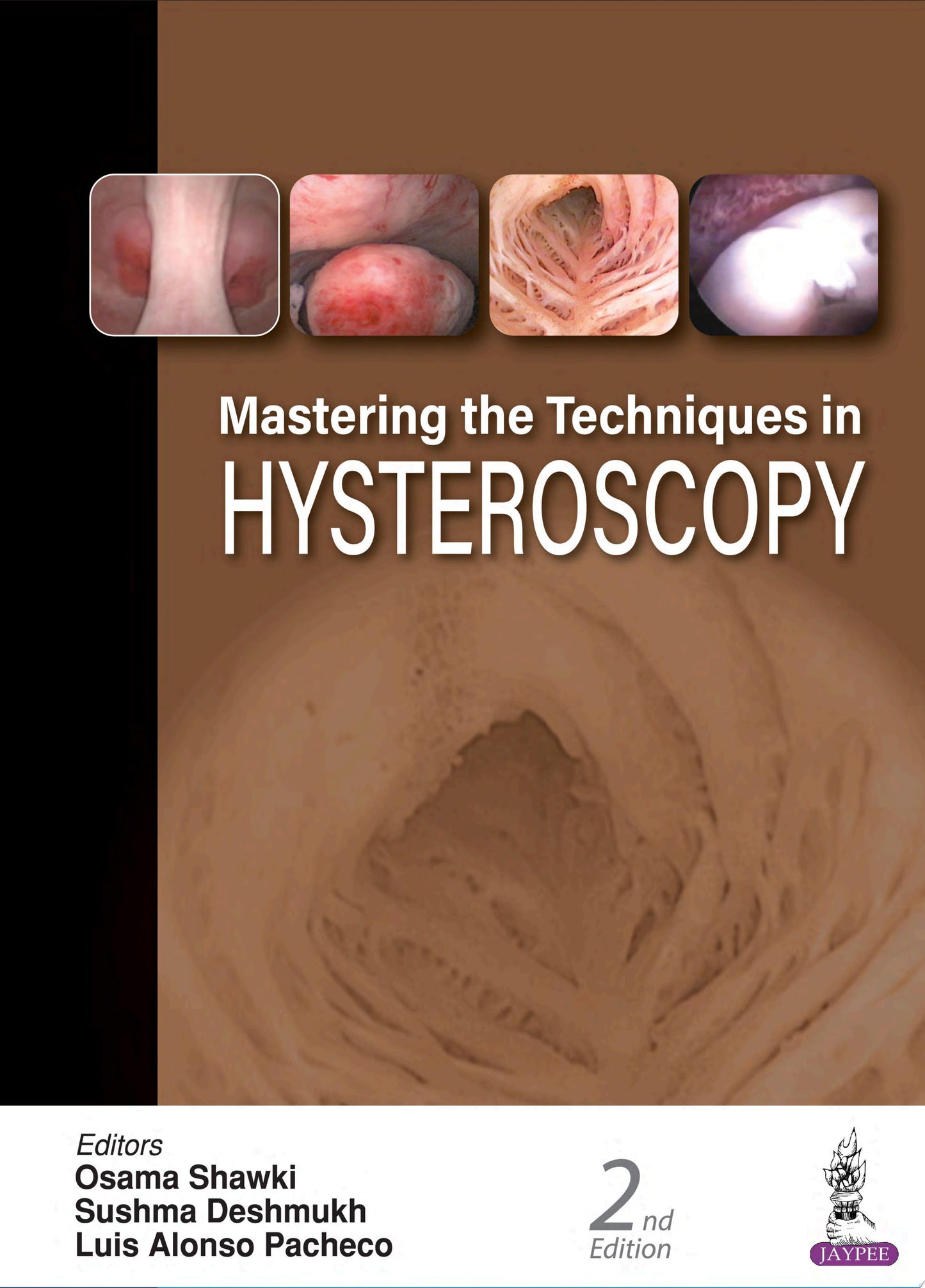 Mastering the Techniques in Hysteroscopy, 2nd edition
