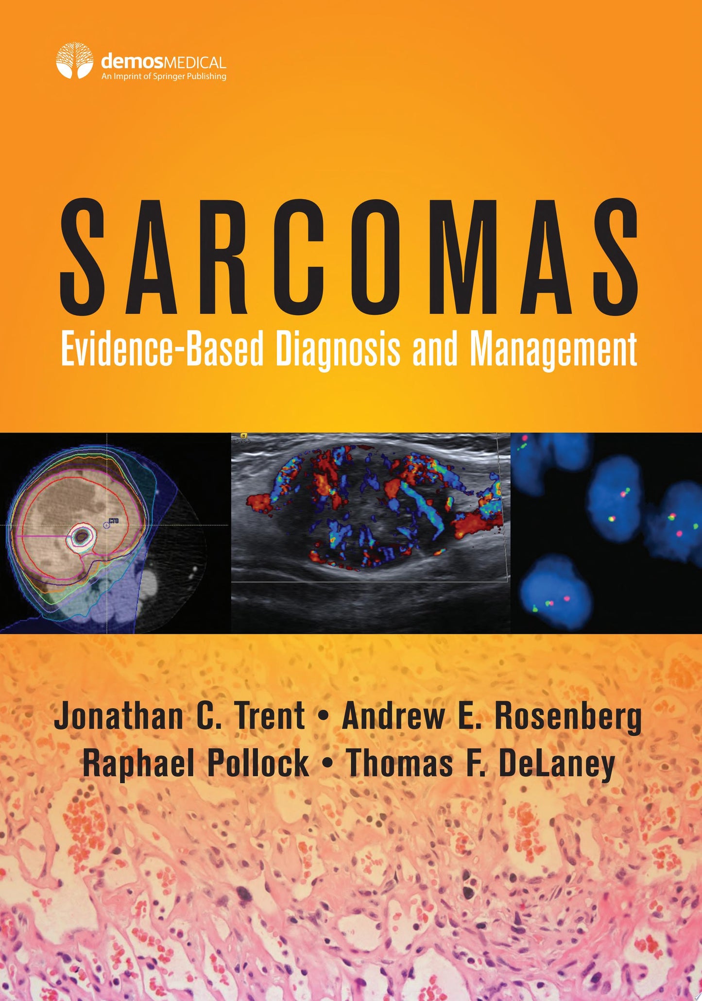 Sarcomas: Evidence-based Diagnosis and Management