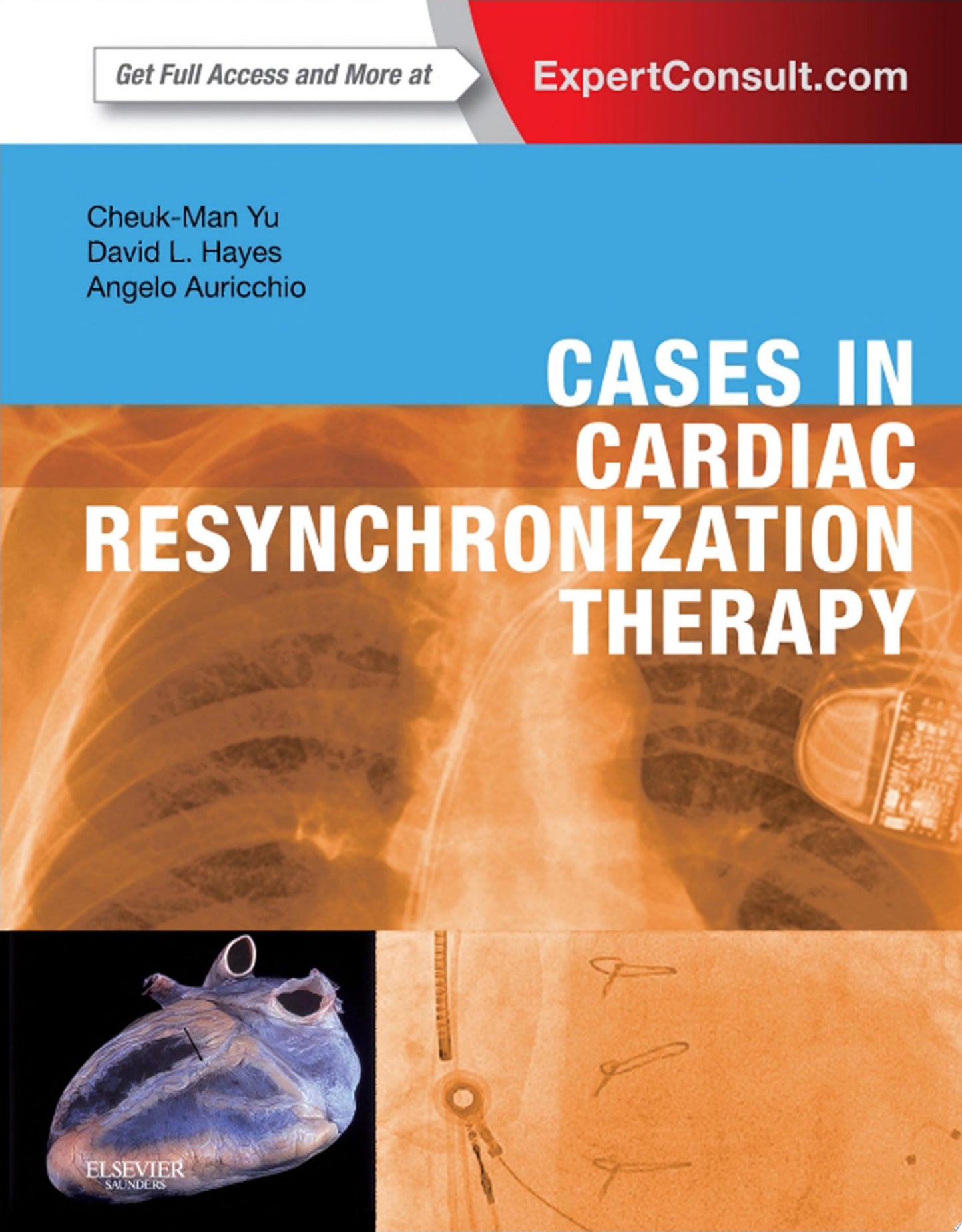 Cases in Cardiac Resynchronization Therapy: Expert Consult – Online and Print