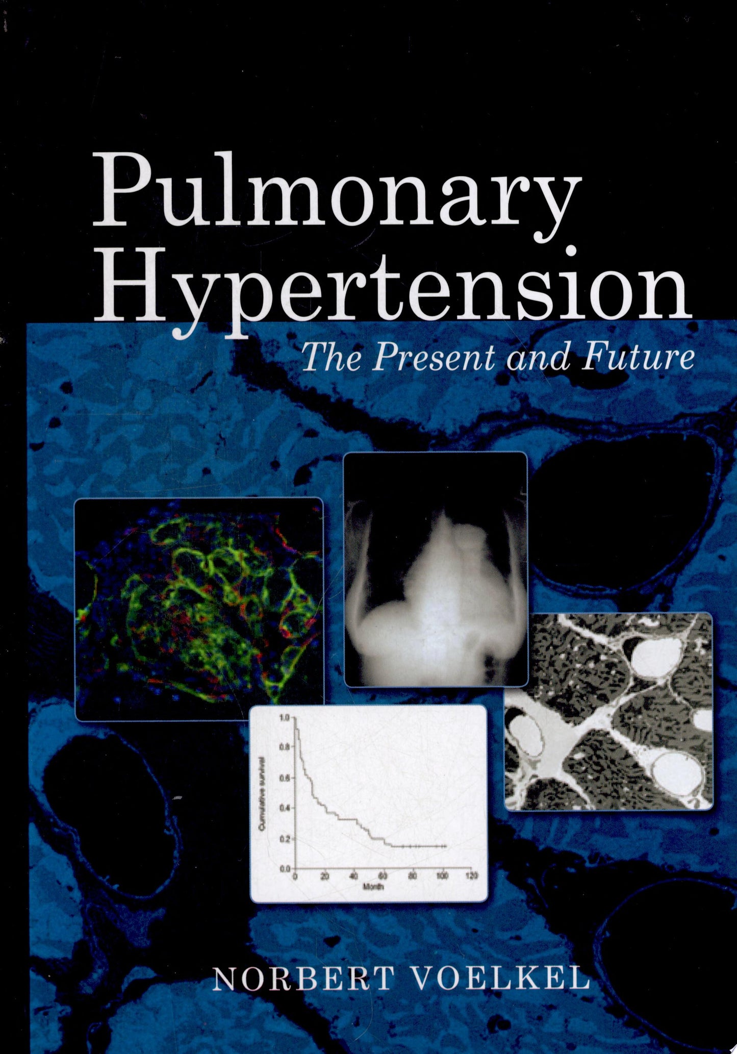 Pulmonary Hypertension: The Present and Future