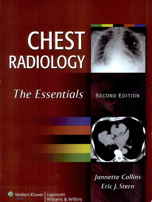 Chest Radiology: The Essentials, 2nd Edition