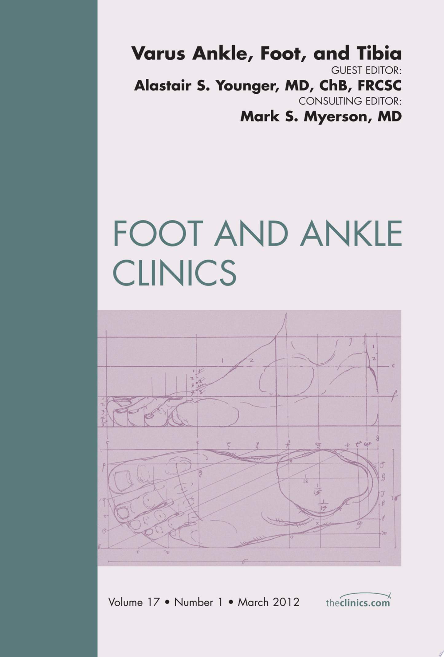 Varus Foot, Ankle, and Tibia, An Issue of Foot and Ankle Clinics, 1th edition (The Clinics: Orthopedics)