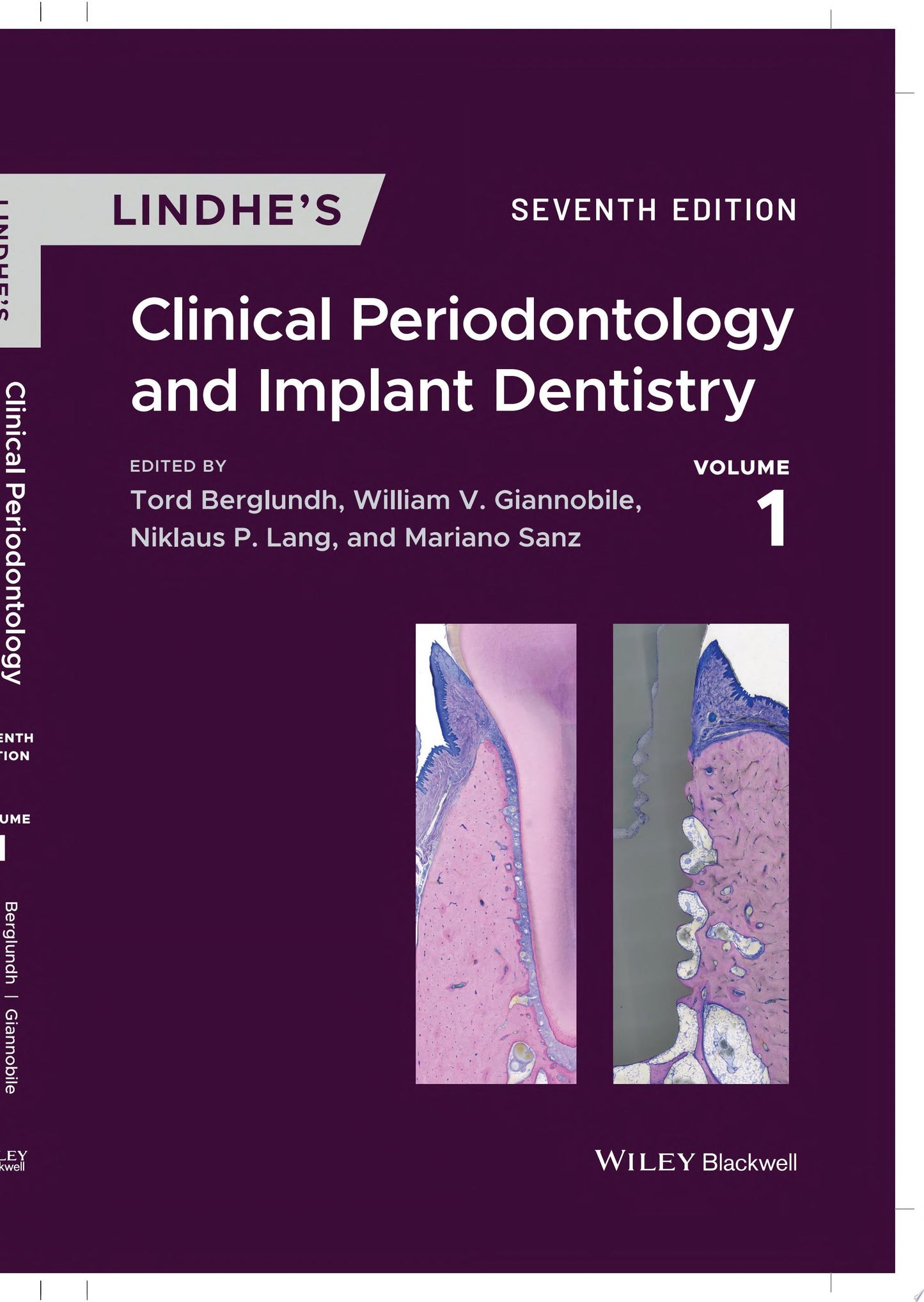 Lindhe's Clinical Periodontology and Implant Dentistry