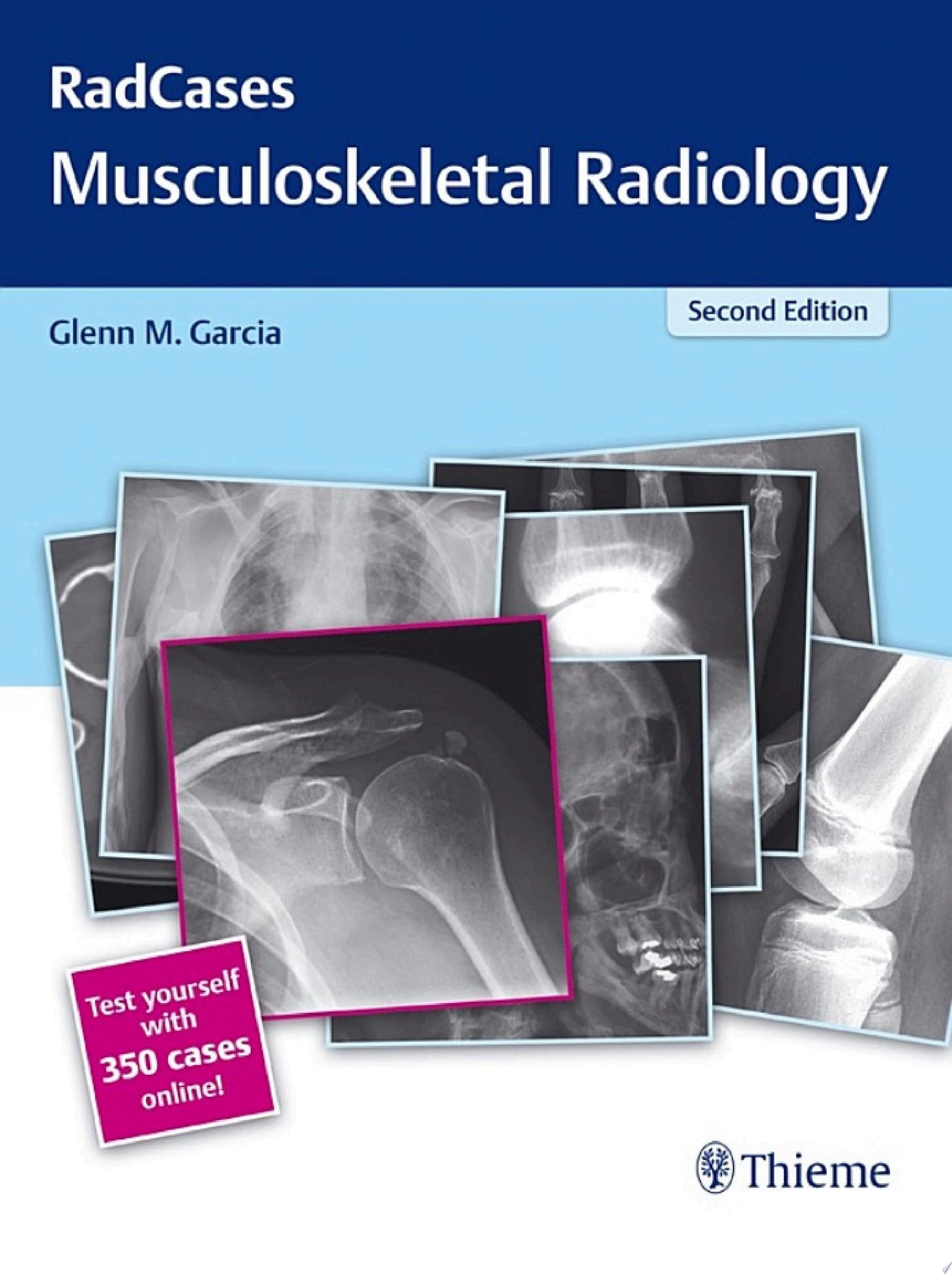 RadCases Q&A Musculoskeletal Radiology, 2nd Edition