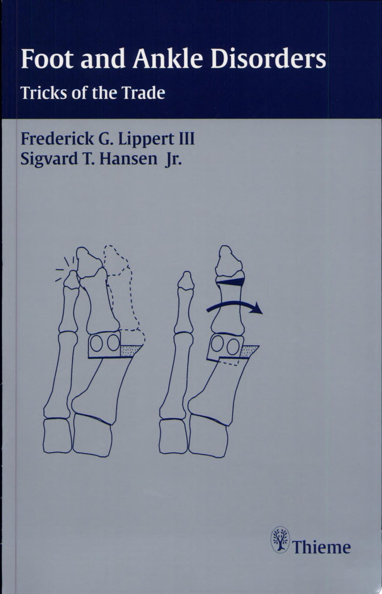 Foot and Ankle Surgery: Tricks of the Trade 1st Edition