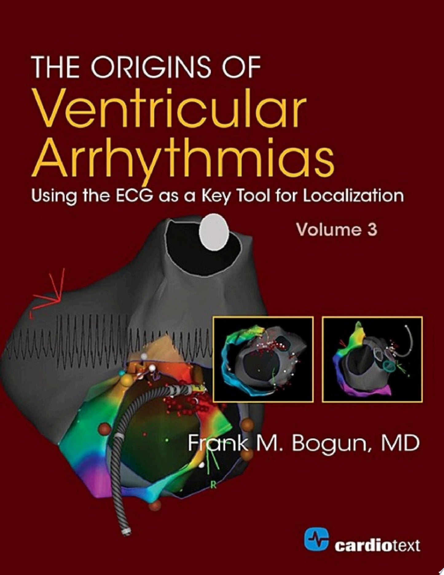 The Origins of Ventricular Arrhythmias: Using the ECG as a Key Tool for Localization, Volume 3