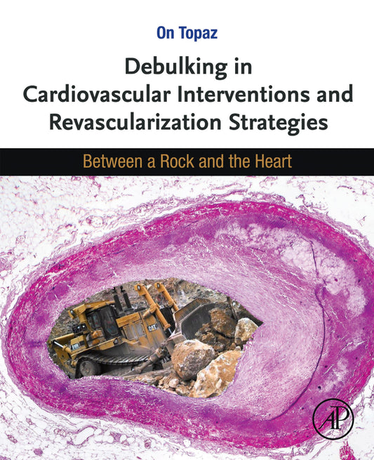 Debulking in Cardiovascular Interventions and Revascularization Strategies: Between a Rock and the Heart