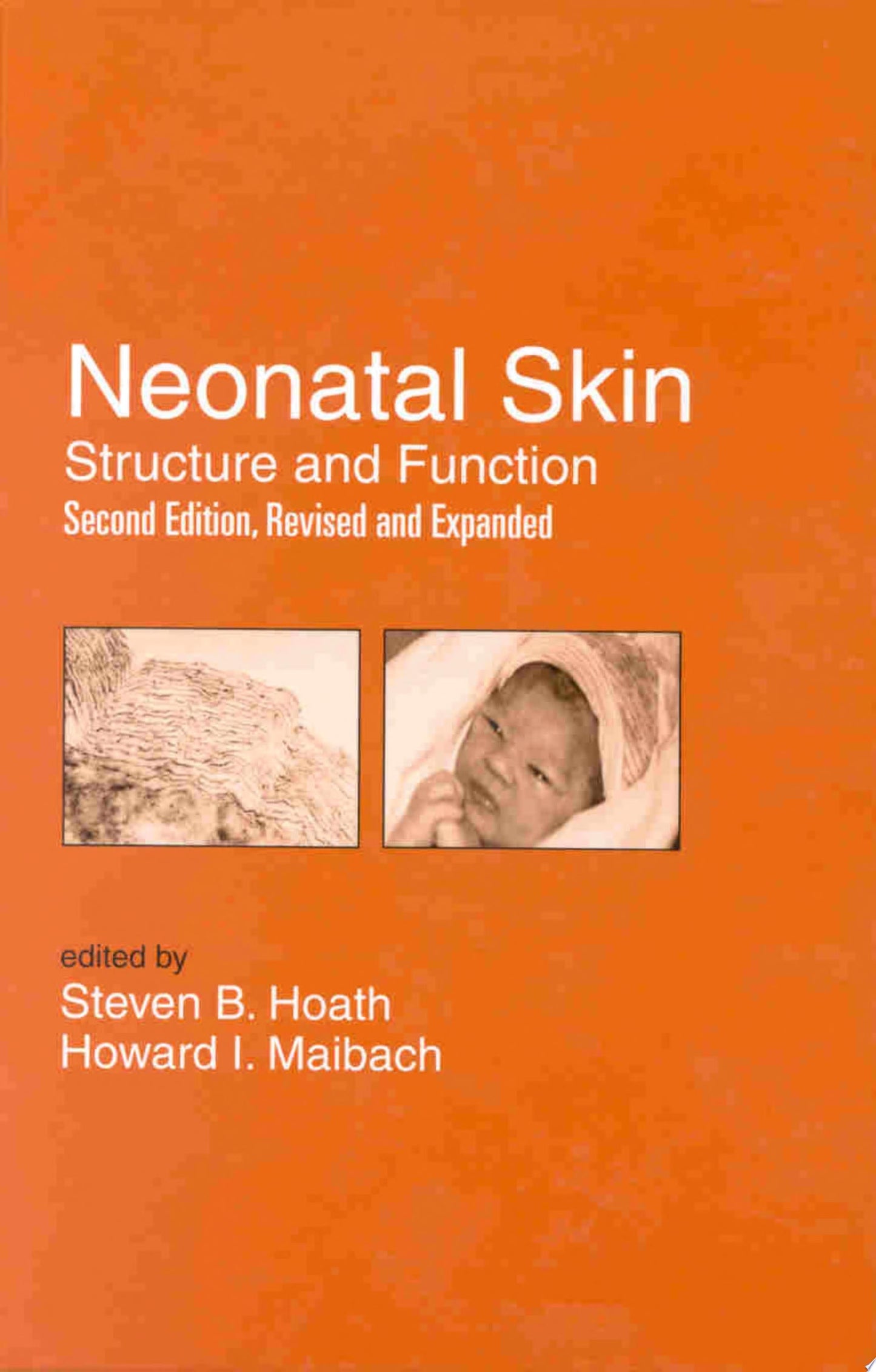 Neonatal Skin: Structure and Function