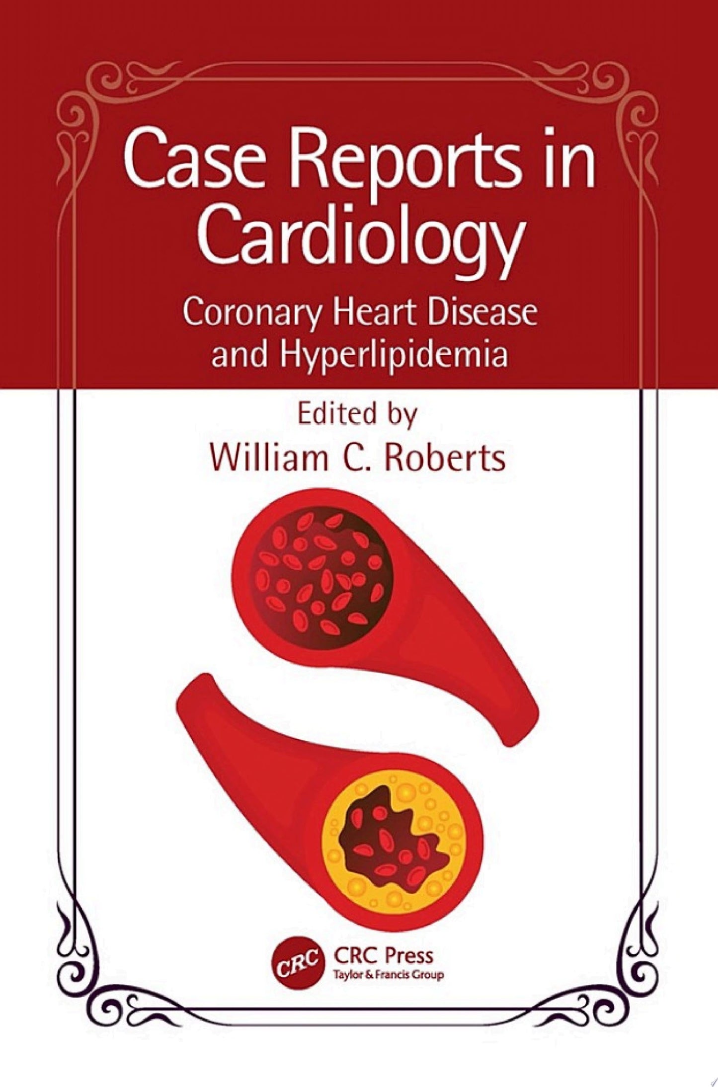 Case Reports in Cardiology: Coronary Heart Disease and Hyperlipidemia