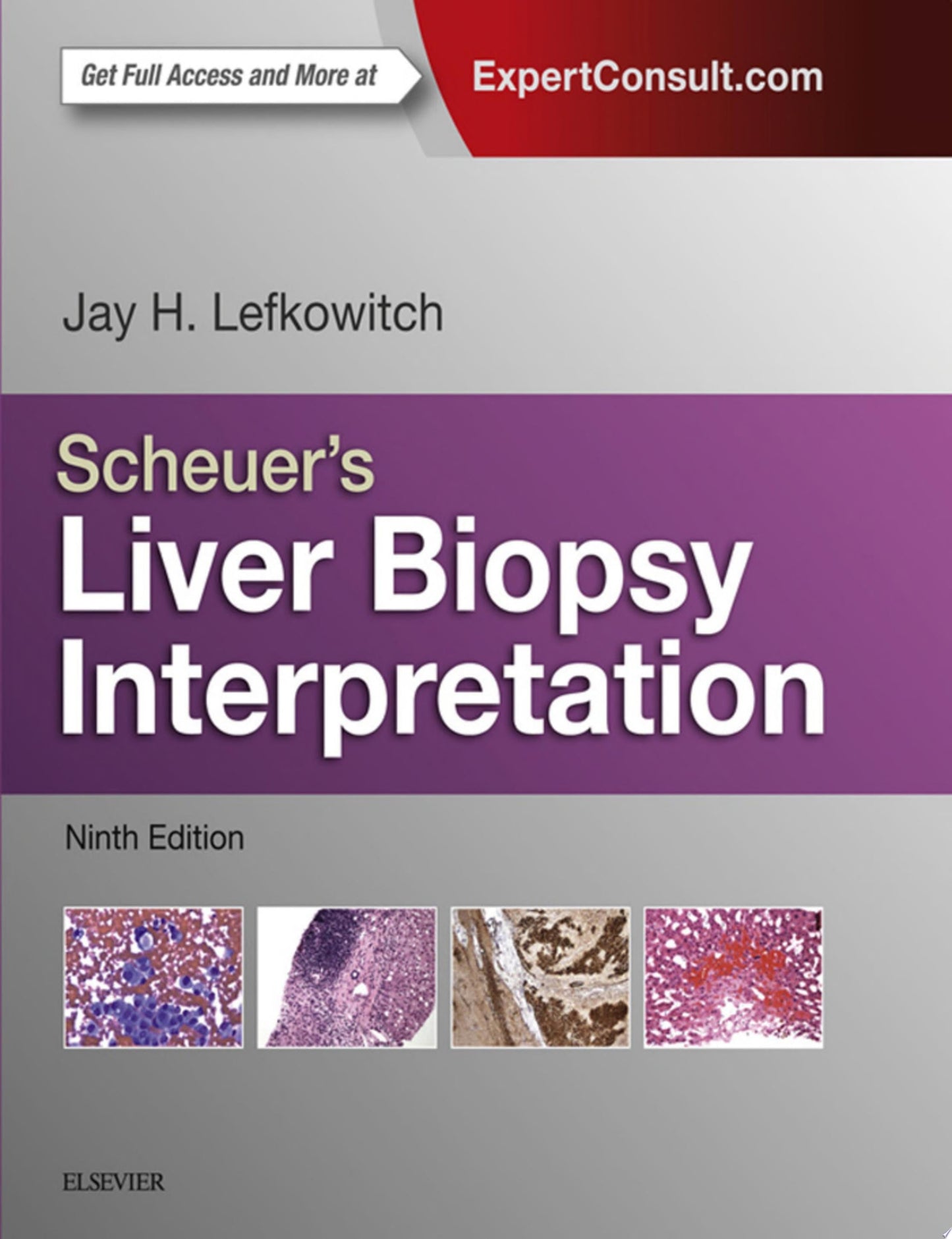 Scheuer’s Liver Biopsy Interpretation, 9th Edition