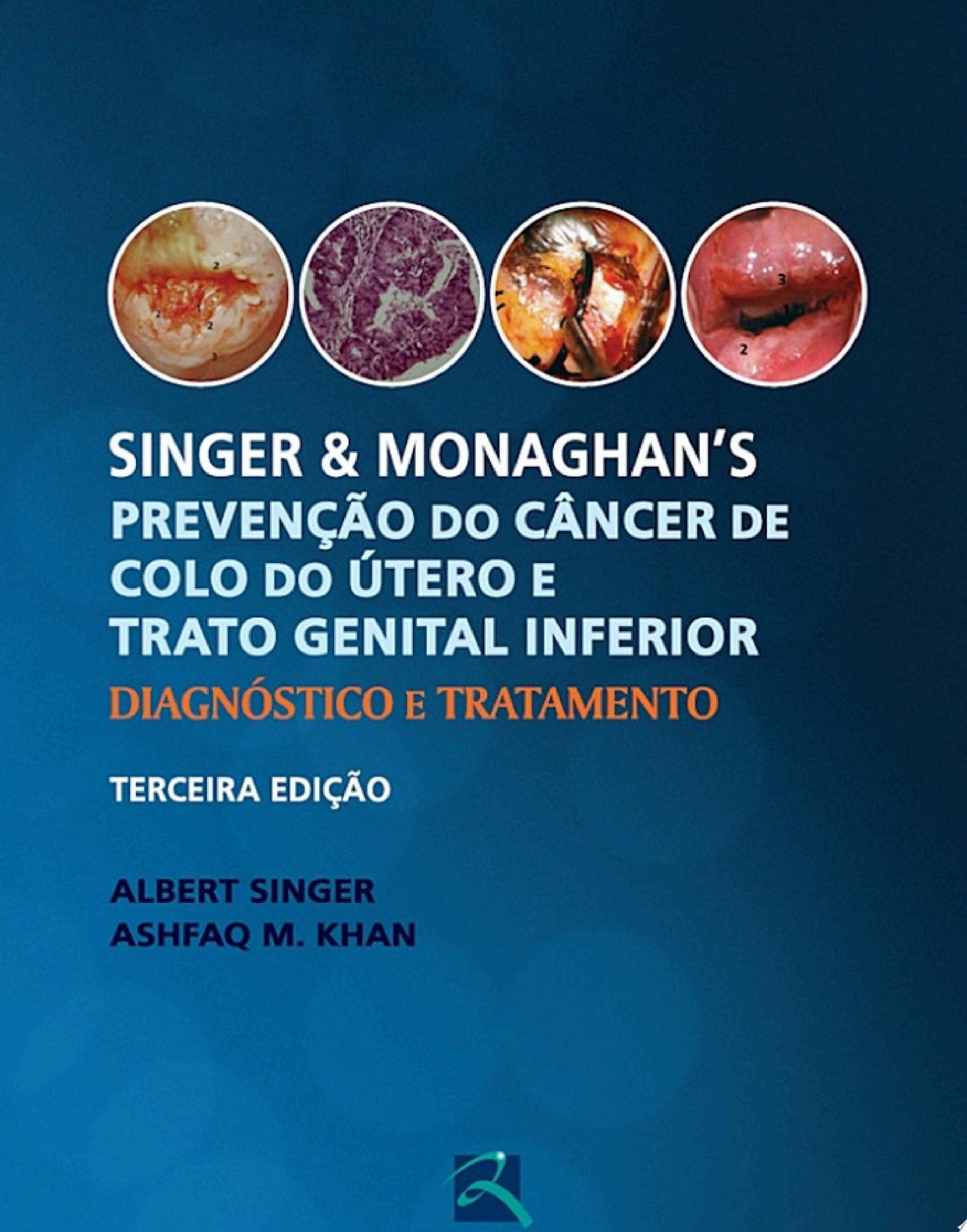 Singer e Monaghan’s Prevenção do Câncer de Colo do Útero e Trato Genital Inferior: Diagnóstico e Tratamento, 3rd Edition