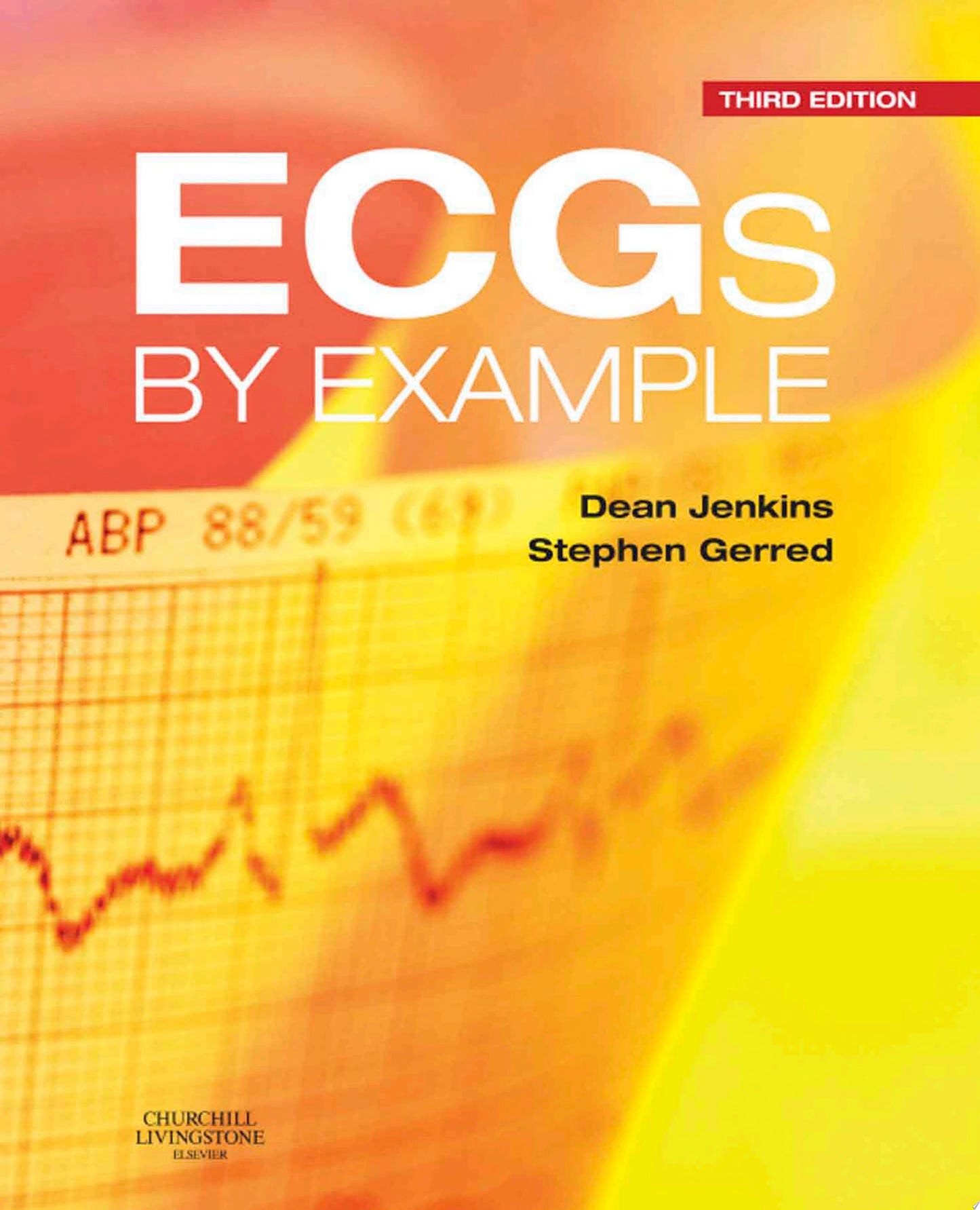 ECGs by Example, 3rd Edition