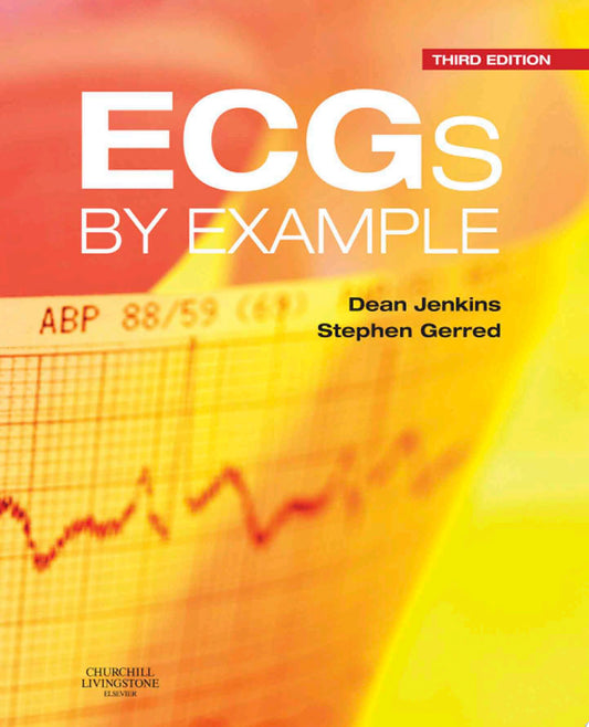ECGs by Example, 3rd Edition