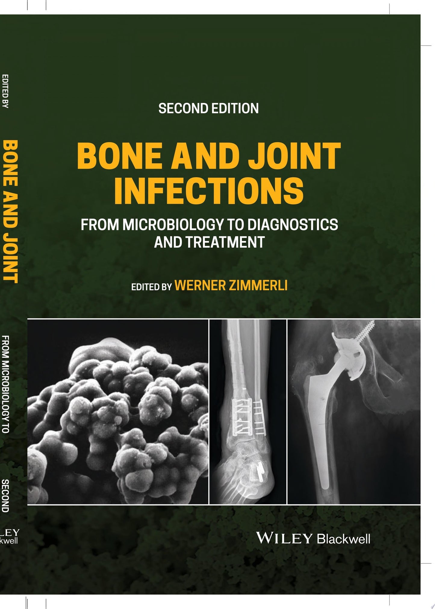 Bone and Joint Infections: From Microbiology to Diagnostics and Treatment, 2nd edition